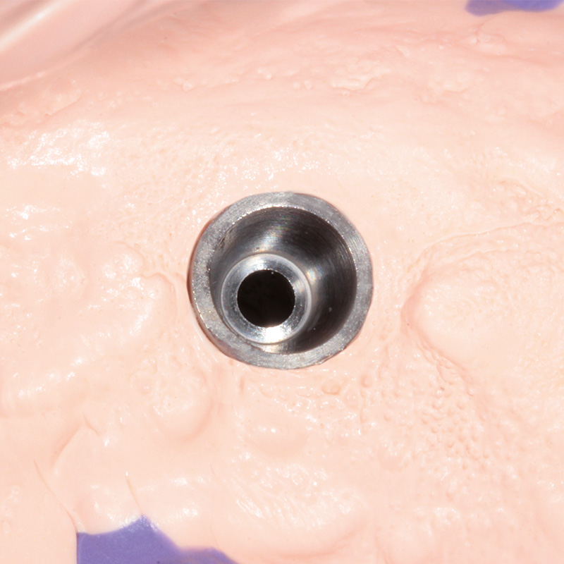 Hydrorise Implant Medium Body